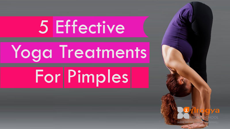 5 Effective Yoga Treatments For Pimples