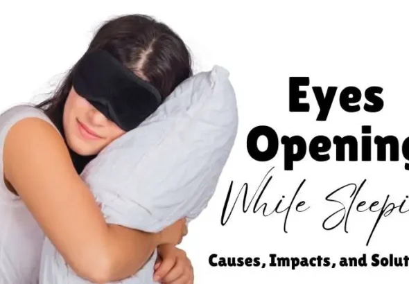 Eyes Opening While Sleeping